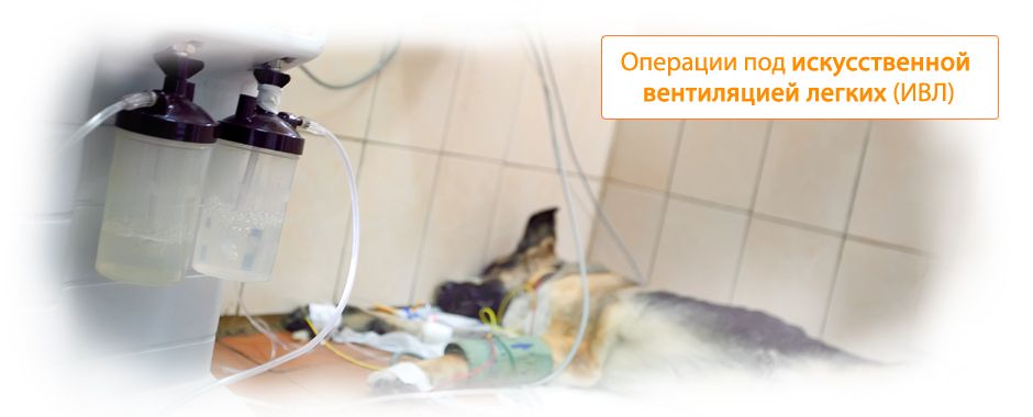 Операции под искусственной вентиляцией легких (ИВЛ)