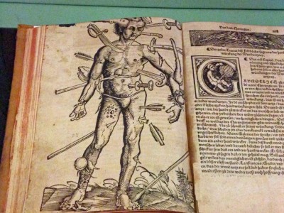 глава из книги 16 века что делать если ранили человека в ту или иную область